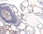 TRIM24 Antibody in Immunohistochemistry (Paraffin) (IHC (P))