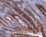 FGFR1OP Antibody in Immunohistochemistry (Paraffin) (IHC (P))