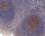 FGFR1OP Antibody in Immunohistochemistry (Paraffin) (IHC (P))