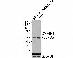 FGFR1OP Antibody in Western Blot (WB)