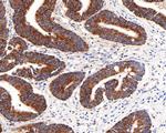 MDH2 Antibody in Immunohistochemistry (Paraffin) (IHC (P))