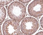 MDH2 Antibody in Immunohistochemistry (Paraffin) (IHC (P))