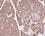 KCTD9 Antibody in Immunohistochemistry (Paraffin) (IHC (P))