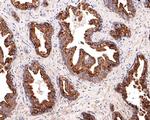 KCTD9 Antibody in Immunohistochemistry (Paraffin) (IHC (P))