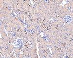 ADSS Antibody in Immunohistochemistry (Paraffin) (IHC (P))