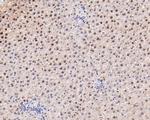 ADSS Antibody in Immunohistochemistry (Paraffin) (IHC (P))