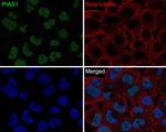 PIAS1 Antibody in Immunocytochemistry (ICC/IF)