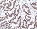 PIAS1 Antibody in Immunohistochemistry (Paraffin) (IHC (P))