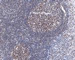 PIAS1 Antibody in Immunohistochemistry (Paraffin) (IHC (P))