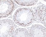 PIAS1 Antibody in Immunohistochemistry (Paraffin) (IHC (P))