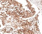 RSK2 Antibody in Immunohistochemistry (Paraffin) (IHC (P))