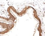 RSK2 Antibody in Immunohistochemistry (Paraffin) (IHC (P))