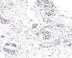 NUP50 Antibody in Immunohistochemistry (Paraffin) (IHC (P))