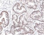 NUP50 Antibody in Immunohistochemistry (Paraffin) (IHC (P))