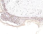 NUP50 Antibody in Immunohistochemistry (Paraffin) (IHC (P))