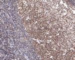 NUP50 Antibody in Immunohistochemistry (Paraffin) (IHC (P))