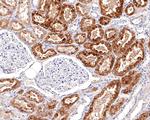 Napsin A Antibody in Immunohistochemistry (Paraffin) (IHC (P))