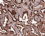 Napsin A Antibody in Immunohistochemistry (Paraffin) (IHC (P))