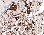 Napsin A Antibody in Immunohistochemistry (Paraffin) (IHC (P))