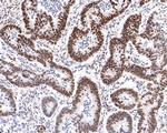 AKAP8 Antibody in Immunohistochemistry (Paraffin) (IHC (P))