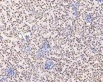 AKAP8 Antibody in Immunohistochemistry (Paraffin) (IHC (P))