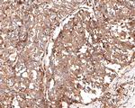 RAB5C Antibody in Immunohistochemistry (Paraffin) (IHC (P))