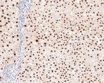 HNF4A Antibody in Immunohistochemistry (Paraffin) (IHC (P))