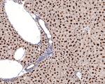 HNF4A Antibody in Immunohistochemistry (Paraffin) (IHC (P))