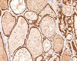 UBE2L3 Antibody in Immunohistochemistry (Paraffin) (IHC (P))