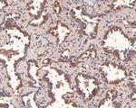 CTPS Antibody in Immunohistochemistry (Paraffin) (IHC (P))