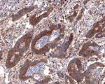 BIN1 Antibody in Immunohistochemistry (Paraffin) (IHC (P))