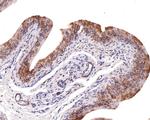 UQCRH Antibody in Immunohistochemistry (Paraffin) (IHC (P))