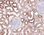 MUT Antibody in Immunohistochemistry (Paraffin) (IHC (P))