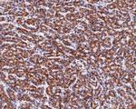 MUT Antibody in Immunohistochemistry (Paraffin) (IHC (P))