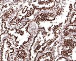 DPF2 Antibody in Immunohistochemistry (Paraffin) (IHC (P))