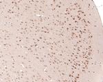 DPF2 Antibody in Immunohistochemistry (Paraffin) (IHC (P))