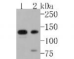 PKN2 Antibody in Western Blot (WB)