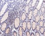 ABRA1 Antibody in Immunohistochemistry (Paraffin) (IHC (P))