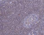 ABRA1 Antibody in Immunohistochemistry (Paraffin) (IHC (P))