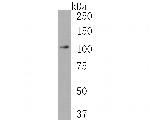 RIG-I Antibody in Western Blot (WB)