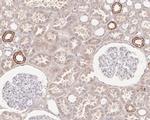 HMGCS2 Antibody in Immunohistochemistry (Paraffin) (IHC (P))