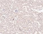 PIAS1 Antibody in Immunohistochemistry (Paraffin) (IHC (P))