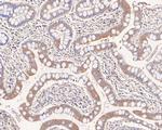 NKp44 Antibody in Immunohistochemistry (Paraffin) (IHC (P))