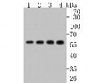 CAP1 Antibody in Western Blot (WB)