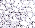 Nkx2.1 Antibody in Immunohistochemistry (Paraffin) (IHC (P))