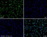 NPY5R Antibody in Immunocytochemistry (ICC/IF)