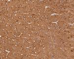 NPY5R Antibody in Immunohistochemistry (Paraffin) (IHC (P))