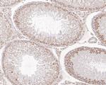 SAMM50 Antibody in Immunohistochemistry (Paraffin) (IHC (P))