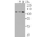 RASA1 Antibody in Western Blot (WB)