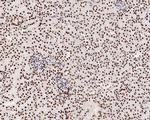 USP39 Antibody in Immunohistochemistry (Paraffin) (IHC (P))